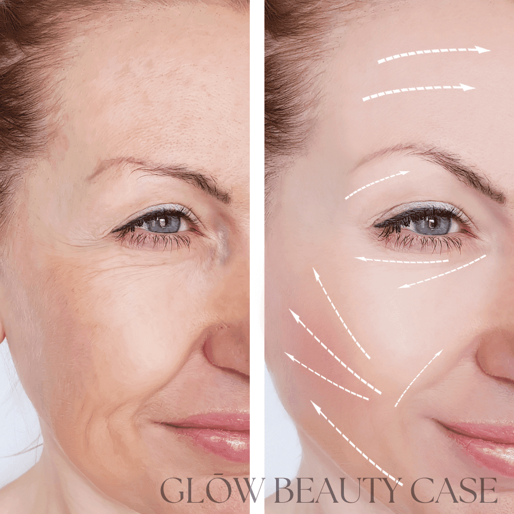 “Before and after facial skin rejuvenation showing wrinkle reduction and lifted skin with glow beauty treatment illustration arrows”